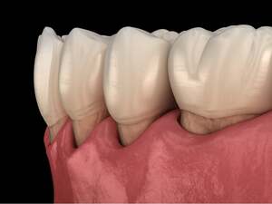 Periodontics